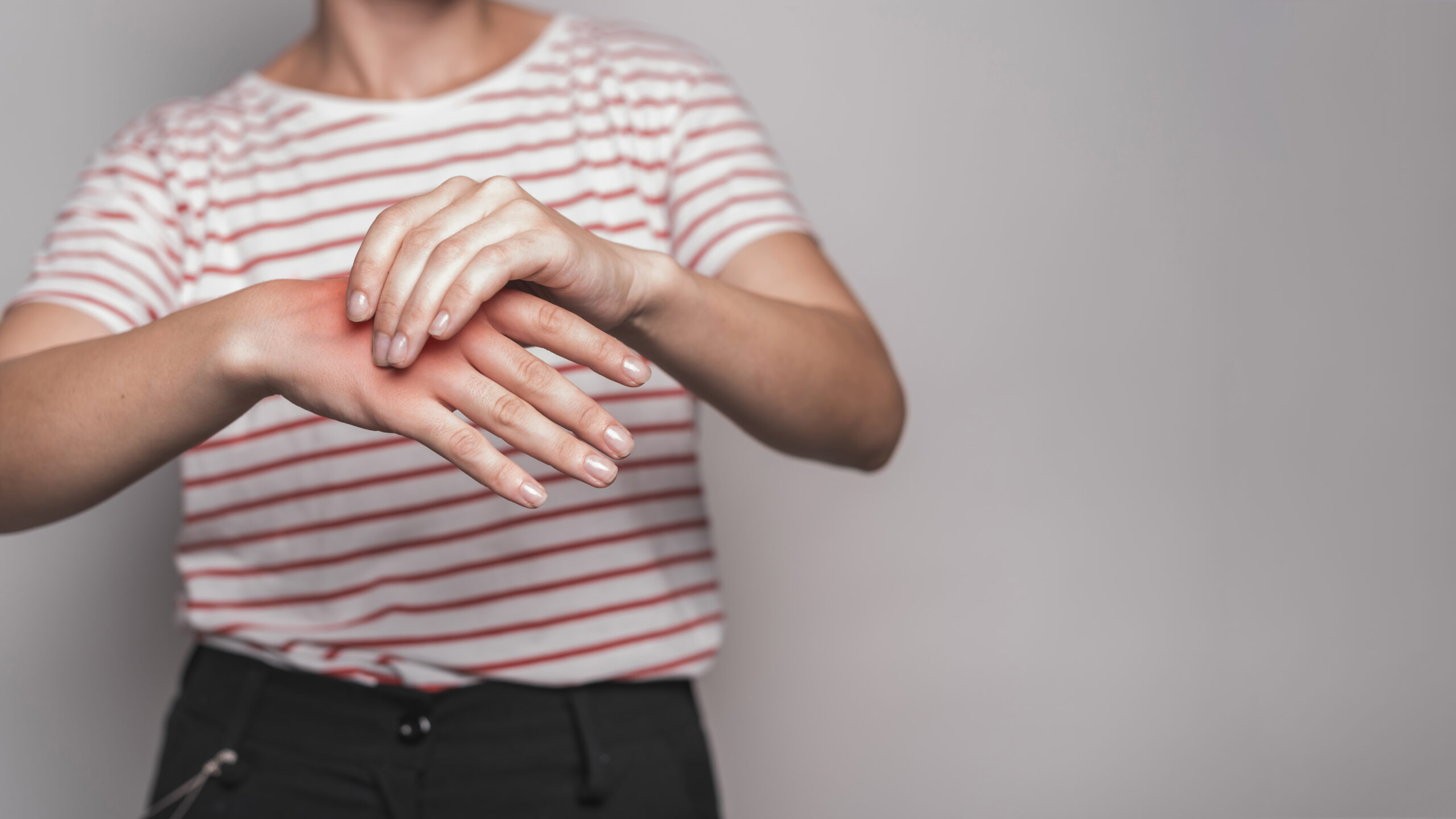 carpal tunnel syndrome